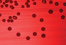 SEPSA – co kosmetolog wiedzieć powinien