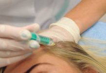 Mezoterapia igłowa skóry głowy