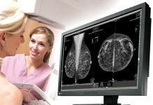 Problemy screeningu raka piersi w Polsce