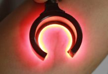 Likwidowanie problemów naczyniowych kończyn dolnych – współpraca lekarza z kosmetologiem