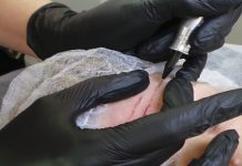 Skin Needling Nowatorska metoda, wykorzystująca urządzenia do makijażu permanentnego w zabiegach kosmetycznych