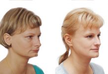 Najnowsze osiągnięcia ortodoncji i ich zastosowanie w poprawie estetyki twarzy