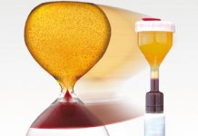 Osocze bogatopłytkowe, naturalne piękno