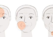 Korekcja zmarszczek i bruzd na skórze twarzy