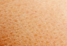 Czynniki zapobiegające utracie wody w pielęgnacji skóry odwodnionej