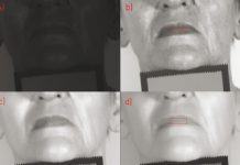 Zastosowanie obrazowania hiperspektralnego w optymalizacji zabiegu laserowego usuwania makijażu permanentnego