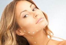 Nici polidioksanowe jako alternatywa dla operacyjnego liftingu twarzy