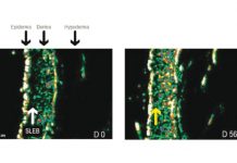 Nieinwazyjne terapie opóźniające procesy starzenia się skóry – przegląd zabiegów