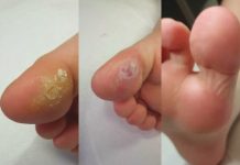 Dziecko w gabinecie podologicznym