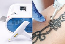 SPEKTAKULARNY LASER YAG Q-SWITCH 1000