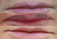 Po pierwsze – nie szkodzić. Ciemna strona makijażu permanentnego