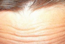 Ocena wpływu wybranych czynników środowiskowych na proces starzenia się skóry