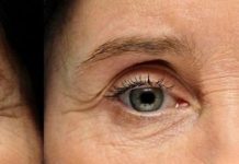 Genetyczne i środowiskowe uwarunkowania parametrów skóry twarzy u kobiet po 45. roku życia i ich korelacje z wiekiem i BMI