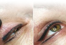 Pigmentacja naprawcza