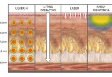 Gorące ultradźwięki. Technologia HIFU