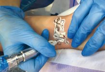 Usuwanie makijażu permanentnego i tatuażu. Lasery kontra preparaty chemiczne