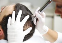 Łysienie u kobiet i mężczyzn a makijaż permanentny