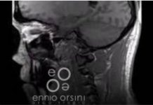 Czy badanie metodą rezonansu magnetycznego, u osób, u których wykonano pigmentację, jest bezpieczne?