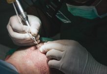 Łysienie androgenowe – rekomendacje Polskiego Towarzystwa Dermatologicznego