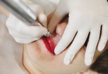 Usta (nie)idealne. Korekta ust asymetrycznych i po rozszczepie