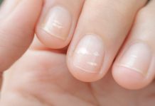 Wiedza pacjentów na temat zmian w obrębie płytki paznokciowej