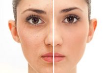 Ocena skuteczności preparatów i zabiegów kosmetycznych u osób z przebarwieniami skóry twarzy