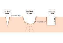 Blizny potrądzikowe – mechanizm powstawania i diagnostyka