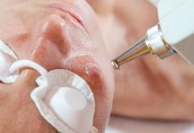 Zastosowanie laseroterapii i intensywnego pulsacyjnego światła w wybranych problemach dermatologicznych i kosmetycznych