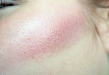 Star Blush. Innowacyjna technika pigmentacji policzków