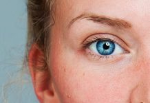 Problemy cery naczyniowej – charakterystyka i niwelowanie zmian