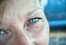 Metody niwelowania hiperpigmentacji skóry w świetle nowych doniesień naukowych