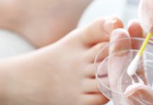 Grzybica paznokci. Czynniki ryzyka, profilaktyka, metody leczenia i pielęgnacji