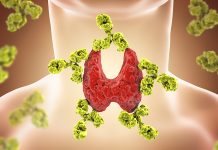 Pielęgnacja skóry u osób chorujących na Hashimoto