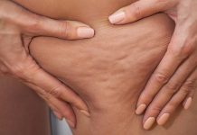 Lipodystrofia – przyczyny i możliwości terapeutyczne