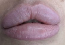 Błędy a powikłania w zabiegach estetycznych. Obszar – twarz