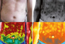 Kiedy ocena palpacyjna klienta to za mało… Diagnostyka obrazowa w zabiegach estetycznych i kosmetologii