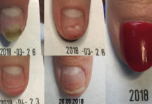 Bo nie wszystko da się zamalować