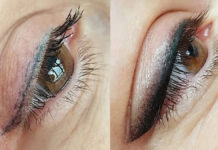 Pigmentacja naprawcza. Gra warta świeczki?