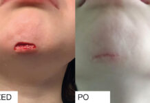 „Na początku było światło” – wywiad z dr. Arturem Markowskim