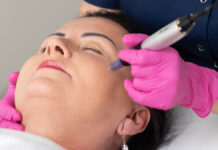 Mezoterapia mikroigłowa. Zadbaj o bezpieczeństwo zabiegu
