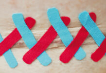 Praktyczne zastosowanie kinesiotapingu na przykładzie blizny po zabiegu cesarskiego cięcia