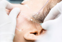 Synergia nici PDO i kwasu L-polimlekowego w terapii anti-age