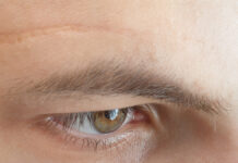 Współczesny model postępowania z problemem blizn w kosmetologii i medycynie estetycznej