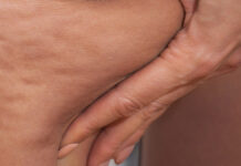 Przegląd najnowszych, skutecznych technik aparaturowych na ciało w gabinetach kosmetologicznych i medycyny estetycznej