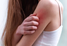 Wpływ chorób autoimmunologicznych na skórę