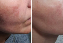 C.O.B SKIN. Podążając za doskonałością