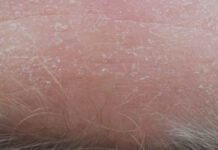 Diagnostyka kosmetologiczna na serio. Cz. 2 – Badanie przedmiotowe