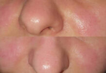 SKÓRA „pocovidowa” w gabinecie