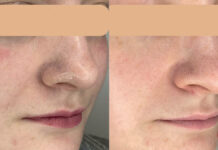 Związek kwasu ferulowego i peptydów w służbie naprawy i ochrony DNA komórek