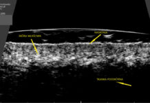 Diagnostyka kosmetologiczna na serio Część 4. Ultrasonografia